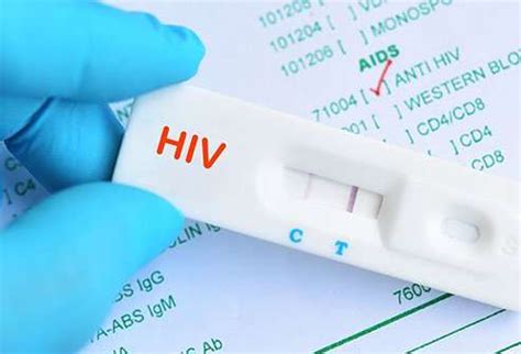 Rapid HIV Testing To Help Everyone Health And Wellness Centers