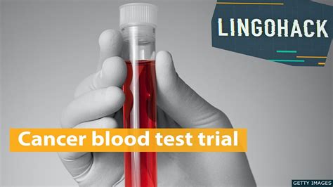 Bbc Learning English Lingohack Cancer Blood Test Trial