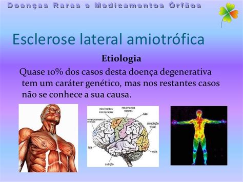 Esclerose Lateral Amiotrófica