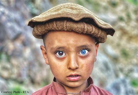 Photos Of Afghan Child With Unique Eye Colors Go Viral Ava