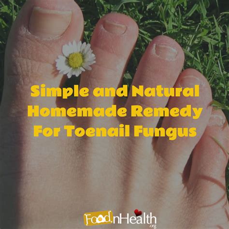 Simple And Natural Homemade Remedy For Toenail Fungus