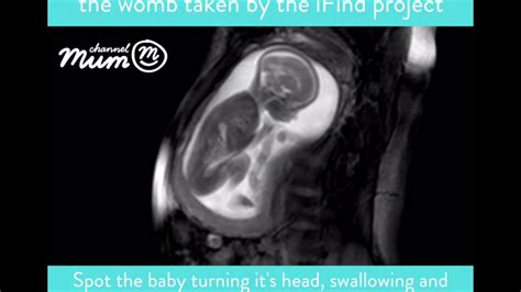 Mri Scan Video Of Baby In The Womb Channel Mum Youtube