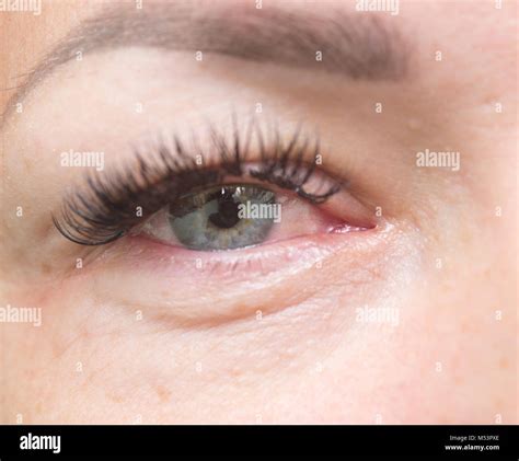 Woman Bloodshot Eyes Hi Res Stock Photography And Images Alamy