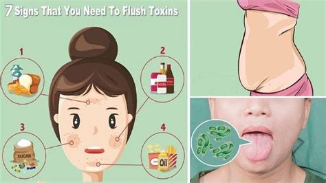 7 Signs Your Body Is Full Of Toxins And Needs A Detox Fast Youtube