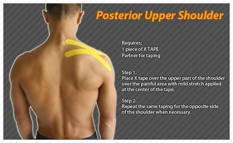 17 Best Images About Ares Tape On Pinterest Knee Pain