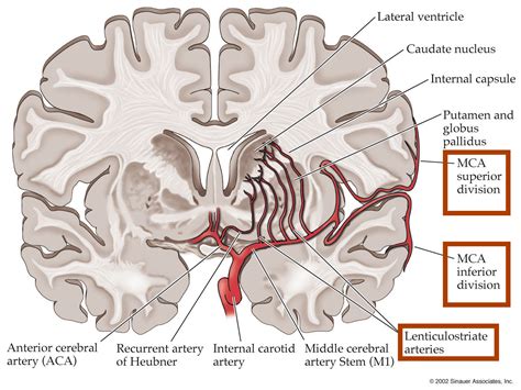 Arteriografy Median Cerebral Artery