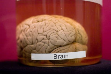 About 100 Brains Are Missing From The University Of Texas Us News