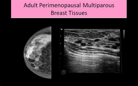 Breast Ultrasound Registry Review Course