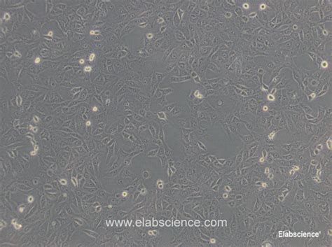 Vero cells are a lineage of cells used in cell cultures. Purchase Vero Cell Line for research and science from ...