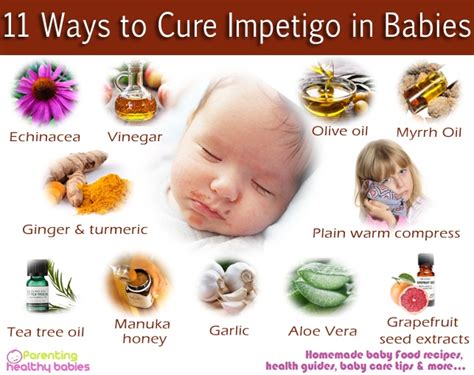 Impetigo In Babies Signs And Symptoms