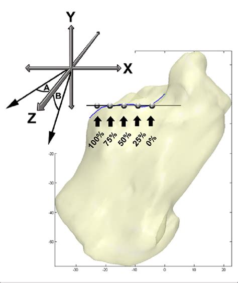 The Model Was Positioned So The Sulcus Calcanei Was Centered Over The