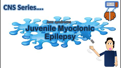 Juvenile Myoclonic Epilepsy Jme Cns Series Ch4 Youtube