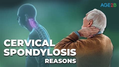 Cervical Spondylosis Causes Symptoms And Treatment How To Stop Youtube