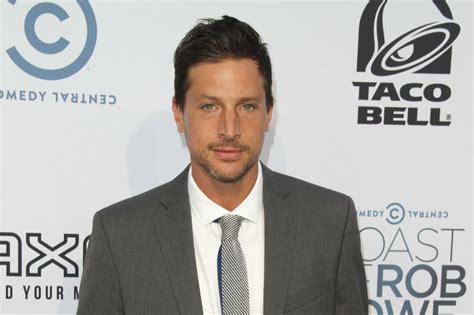 Simon Rex Wants Prosthetic To Go To A Museum