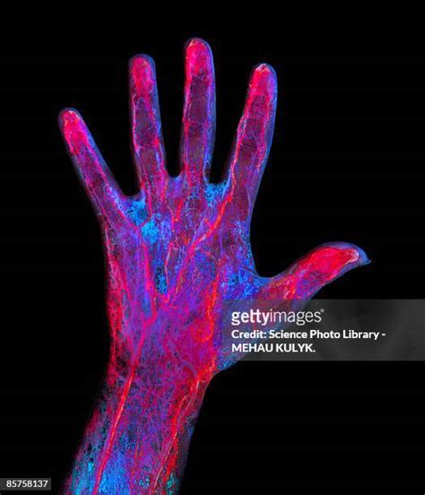 Anatomy Of Arm Veins Photos And Premium High Res Pictures Getty Images