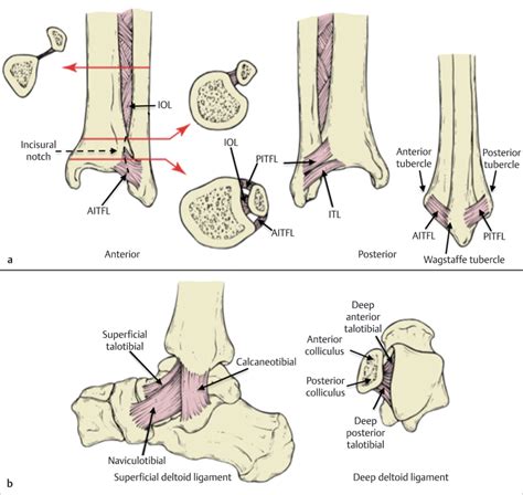43 Ankle Fractures And Dislocations Musculoskeletal Key