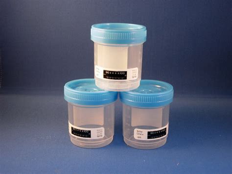 Sterile Urine Specimen Collection Cup Wtemp Strip Medix Your On