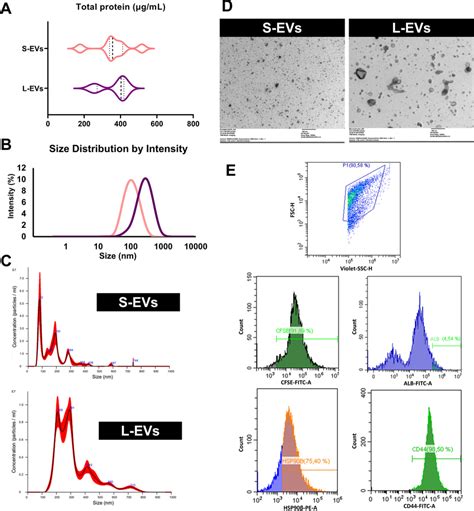 Characterisation Of Small S EV And Large Extracellular Vesicles