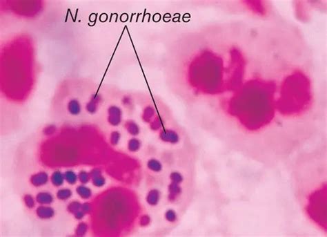 Gram Negative Cocci And Coccobacilli Of Medical Significance List Of