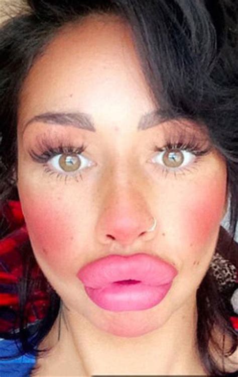 This Woman Wants To Take Her Huge Lips And Make Them Even