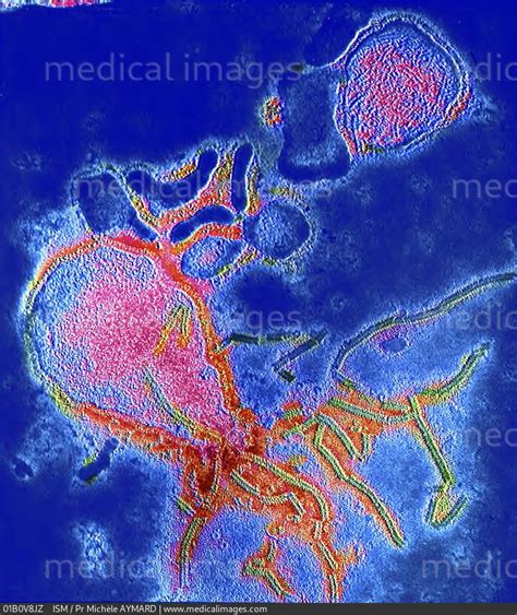 Stock Image Electron Micrograph Of Two Parainfluenza Virus Particles