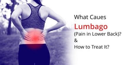 What Is Lumbago Causes Symptoms And How Is It Treated