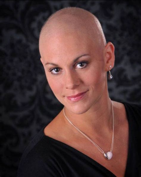 Pin On Balding Hairstyles For Women