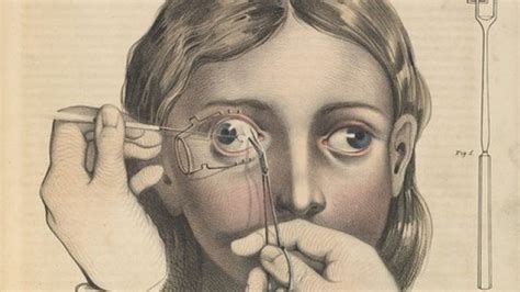Brutal Medical Diagrams Reveal Horrors Of 19th Century Surgery Iflscience