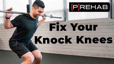 Fixing Your Knock Knees With Two Exercises Youtube