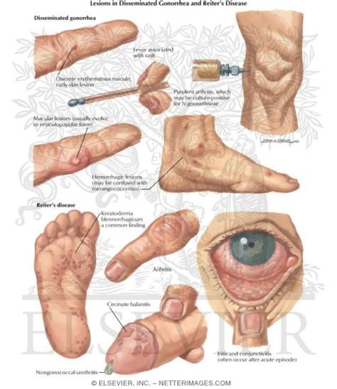 Illustrations In Clinical Symposia