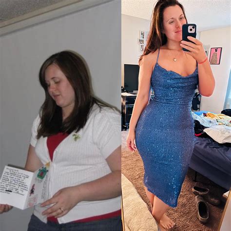 Here You Can See A Progress Photo Showing A Weight Loss From 316 Pounds
