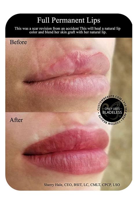 Permanent Makeup Lips Before And After Saubhaya Makeup