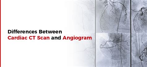 Ct Scan Or Angiogram What Is The Difference