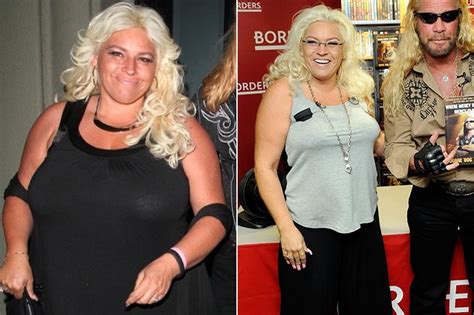 beth chapman plastic surgery click here for the latest on her condition