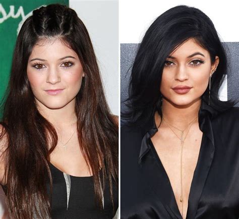 Teenagers And Plastic Surgery Celebrity Influence