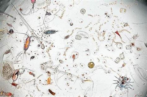 一滴水中的微生物，美丽小世界，可爱的细菌