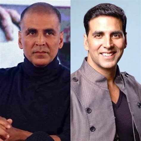 from salman khan to akshay kumar these 5 popular bollywood actors underwent hair transplant surgery