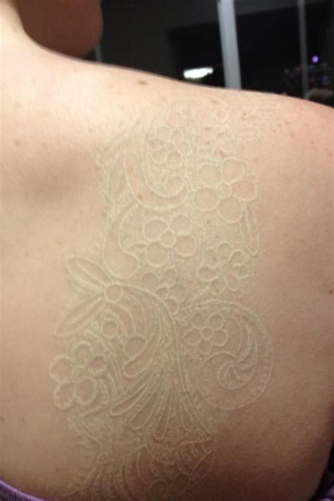 My White Ink Lace Tattoo I Apologize For The Blur It Is