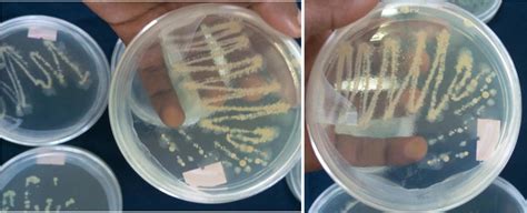 Slimy Mucoid To Mucoidal Yellow Colonies Appearance On Nutrient Agar