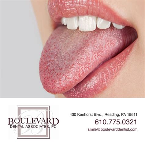 Dry Mouth Symptoms Causes And Treatments Boulevard Dentist
