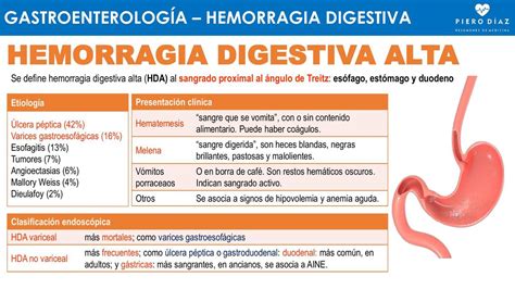 Hemorragia Digestiva Alta HDA Resúmenes de medicina Hot Sex Picture