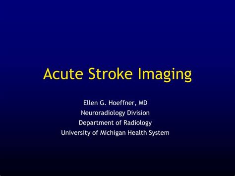 Ppt Acute Stroke Imaging Powerpoint Presentation Free Download Id
