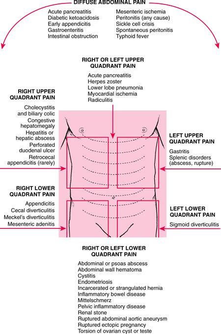 Medical Abdominal Pain Quadrant Wise