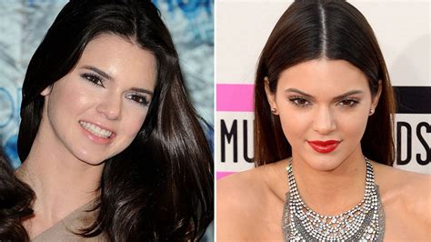 Has Kendall Jenner Had A Nose Job Reality Stars Thinner Features Spark Cosmetic Surgery