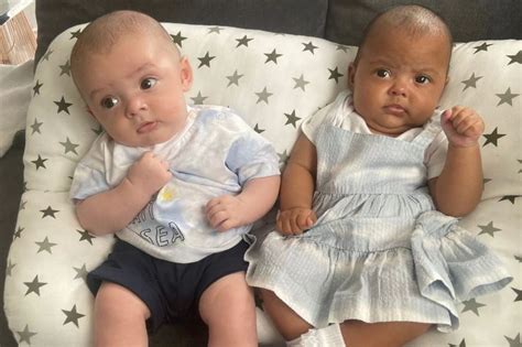Mum Stunned After Twins Born With Different Skin Tones World News