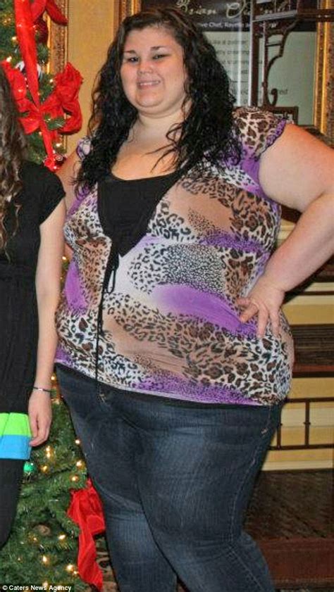 Kaitlyn Smith Who Lost 208lbs In 15 Months Undergoes Excess Skin
