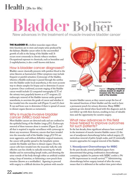 Aggressive Bladder Cancer Advanced Urology