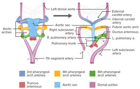 Branchial Apparatus And Aortic Arches Concise Medical Knowledge