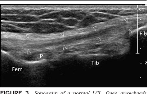 Related online courses on physioplus. Sonographic Examination of Knee Ligaments. | Semantic Scholar