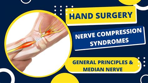 General Principles And Median Nerve Nerve Compression Syndromes Hand